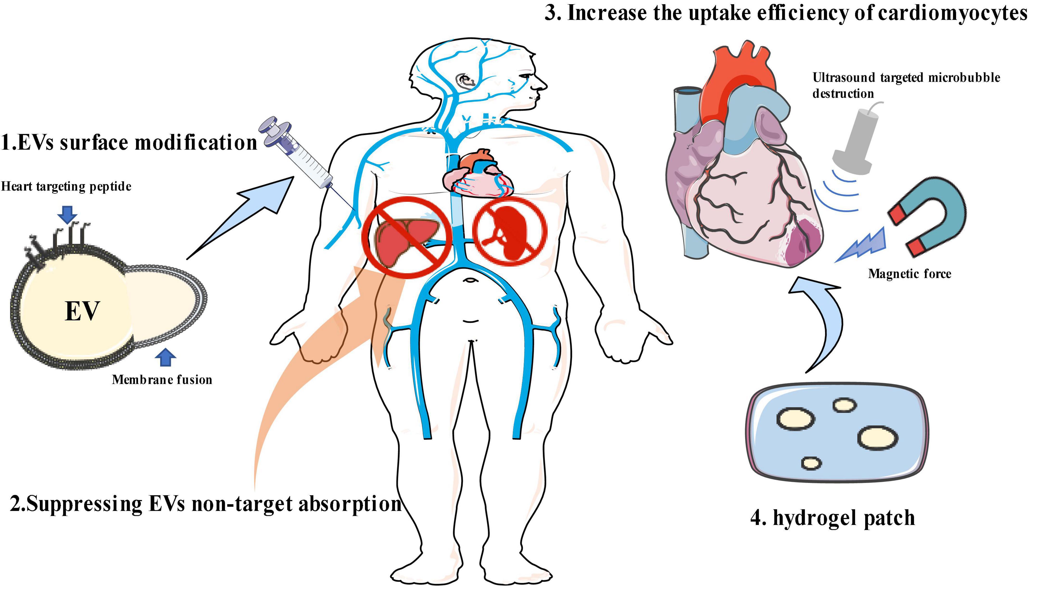 Extracellular vesicles: Targeting the heart